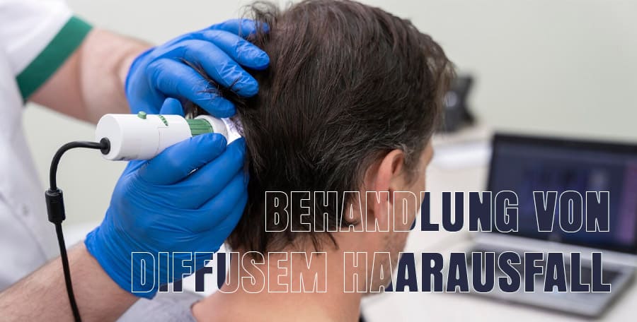 Behandlung von diffusem Haarausfall