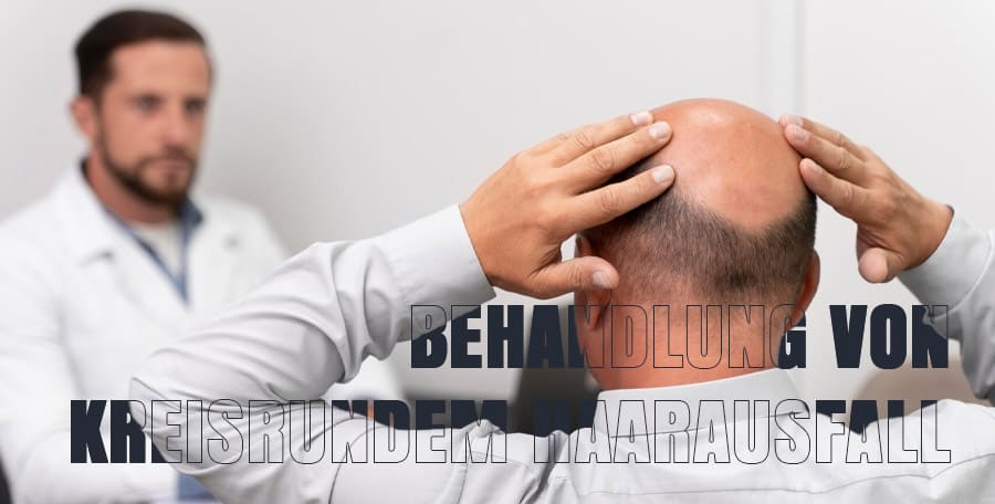 Behandlung von kreisrundem Haarausfall